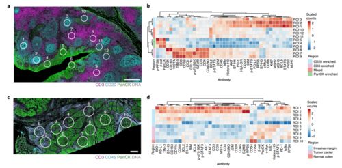 The Luminous Heart of Your Home_ Unveiling the Value of Quartzite-Kangyi artificial marble